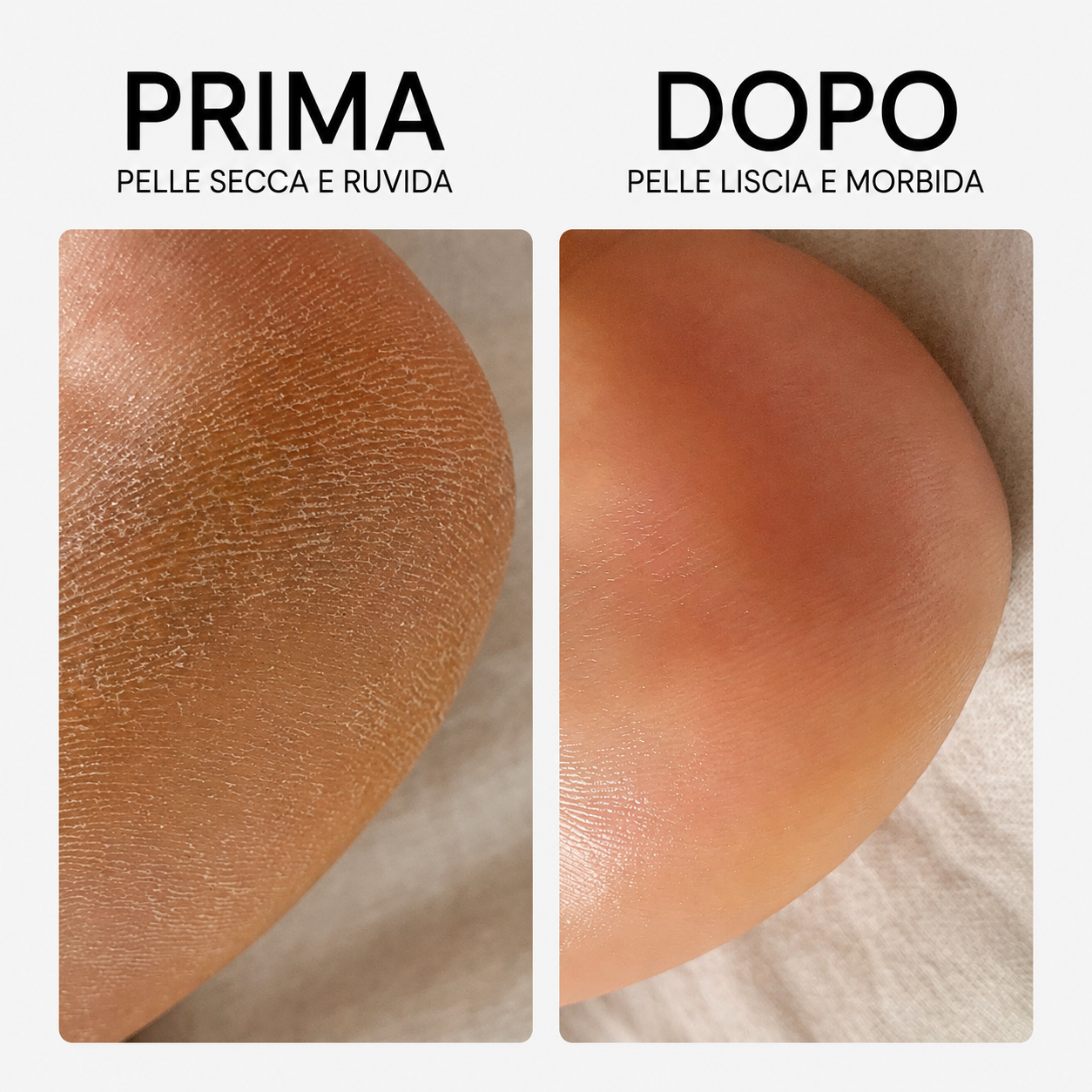 Body Stick esfoliante all'acido glicolico