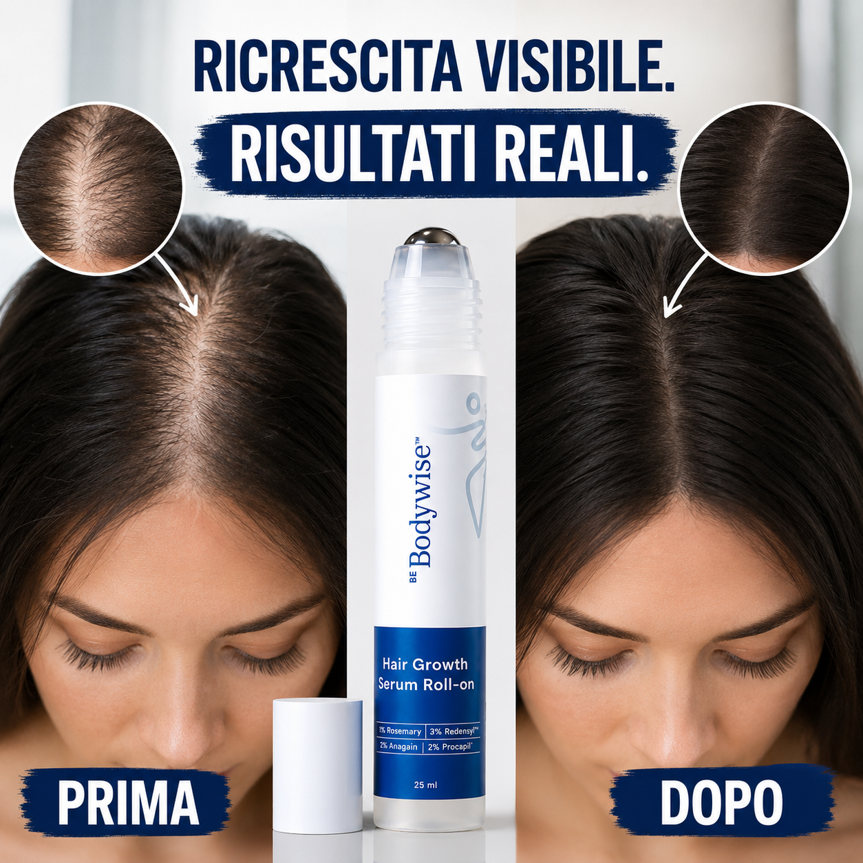 Ricrescita Attiva - Trattamento Roll-On con Cheratina Organica
